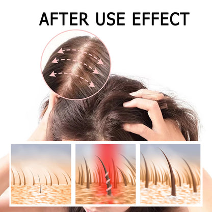【Get 45% Off Now】 Scalp & Hair Care Essential Oil Drops