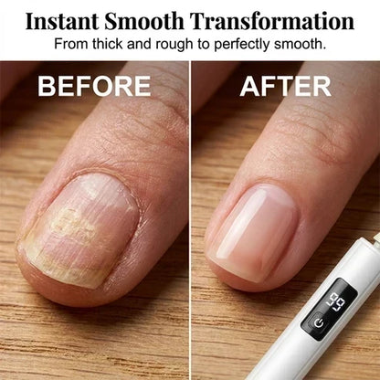 💅✨ Exclusive 40% OFF Add-On — Professional Electric Nail Drill with Smart Digital Display
